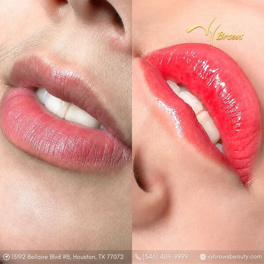 Uneven lip color before and after lip blush