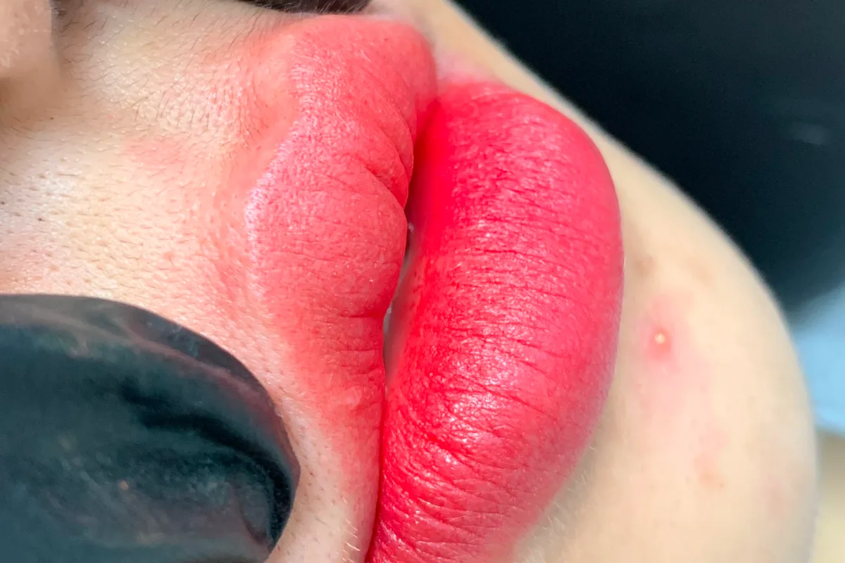Lips 1