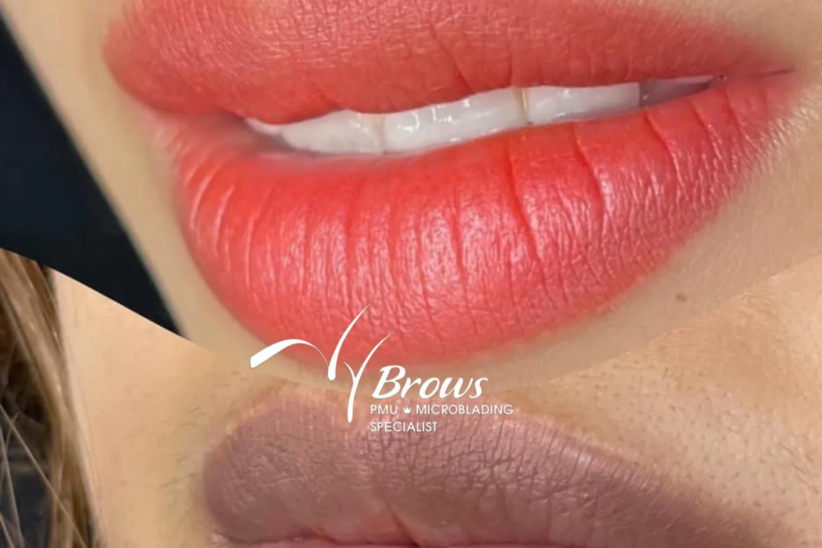 Lips 10