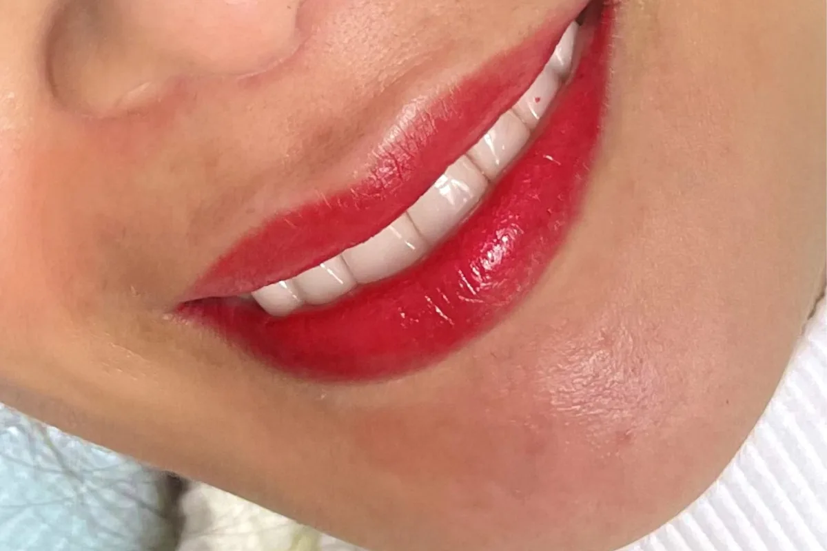 Lips 15