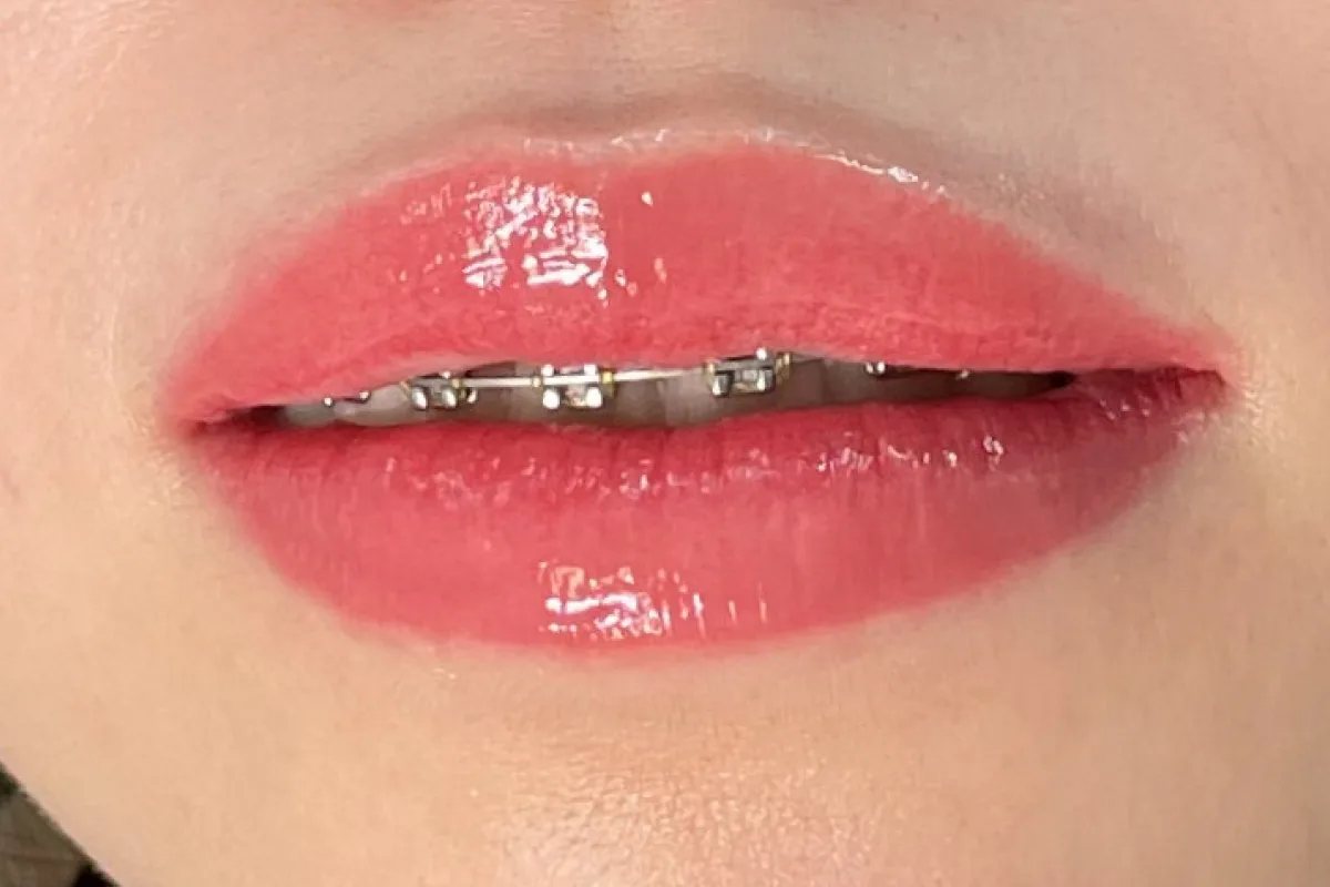 Lips 2