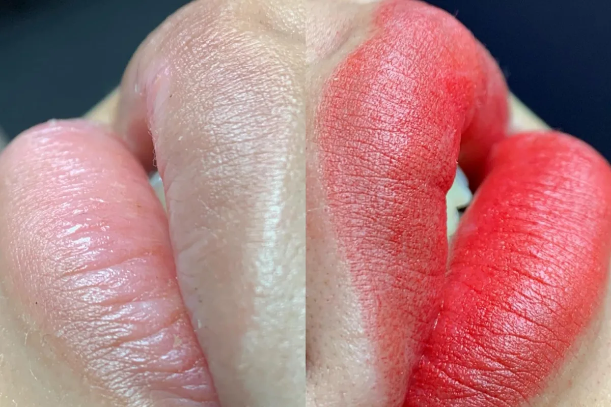 Lips 9