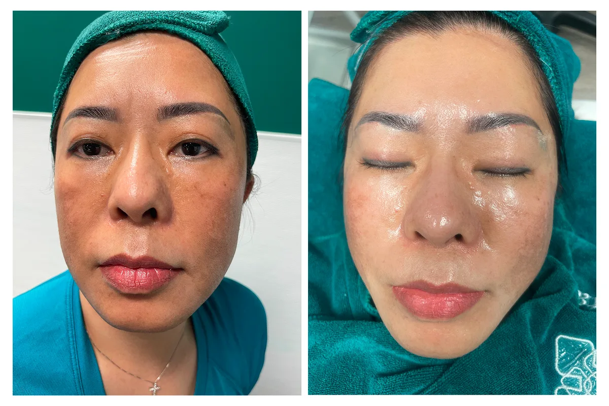 Skincare 1