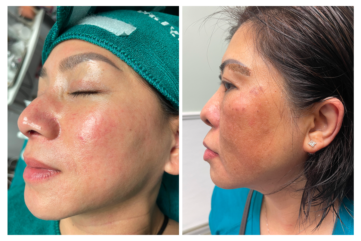 Skincare 2