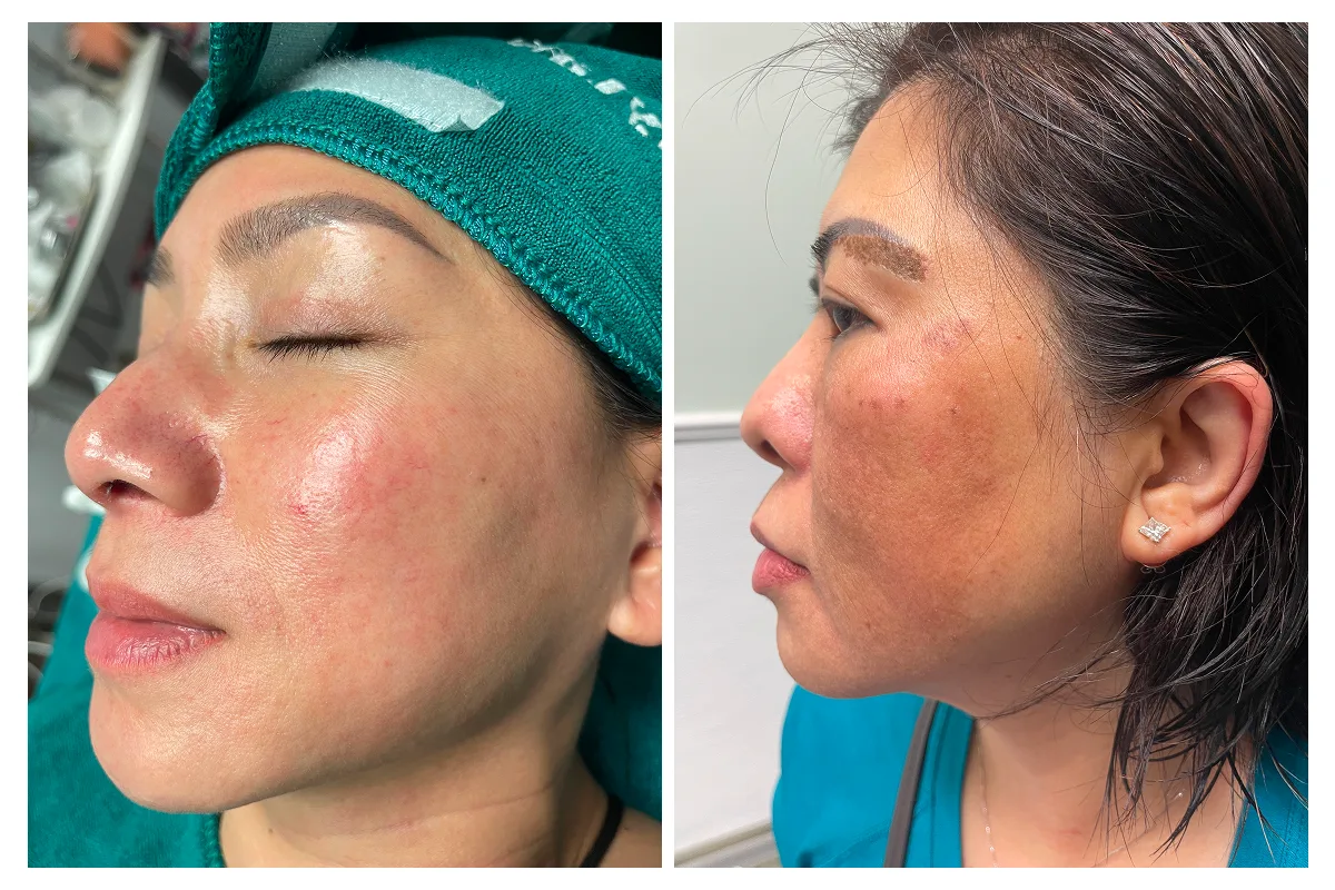 Skincare 2