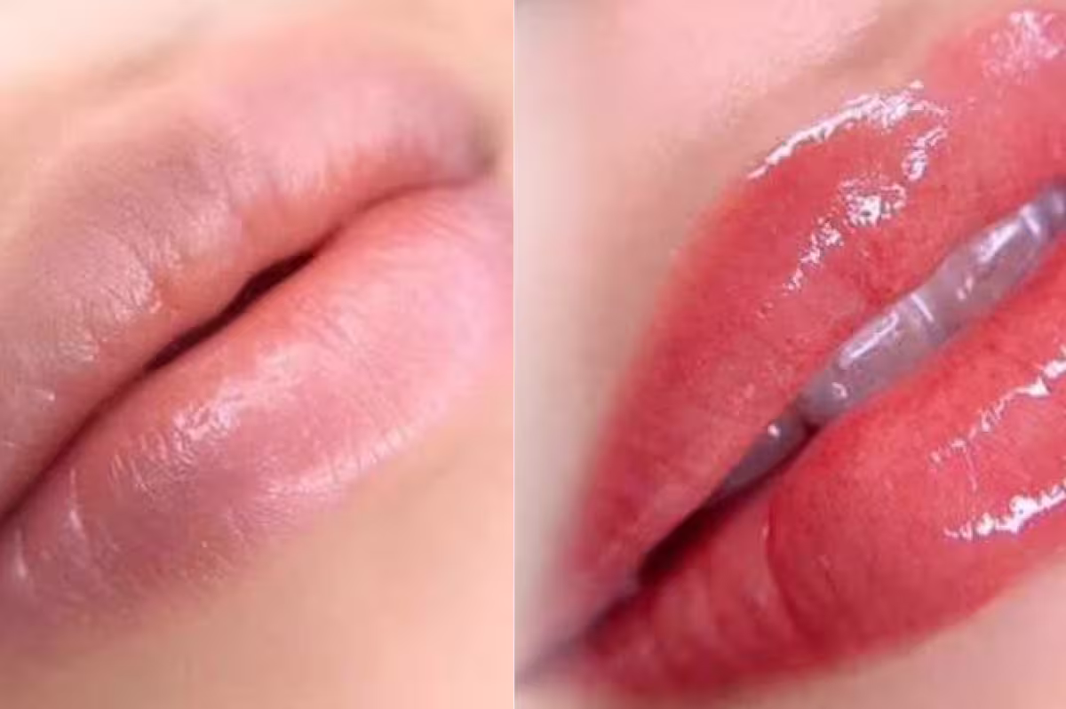 LIP TREATMENTS